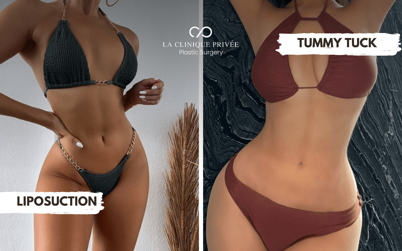 Liposuction vs Tummy Tuck