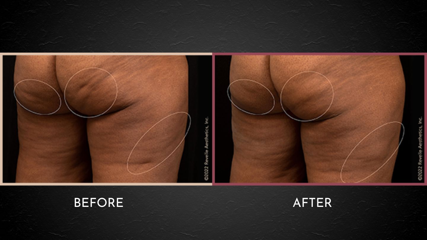 PSP Before After Layout Website (1)