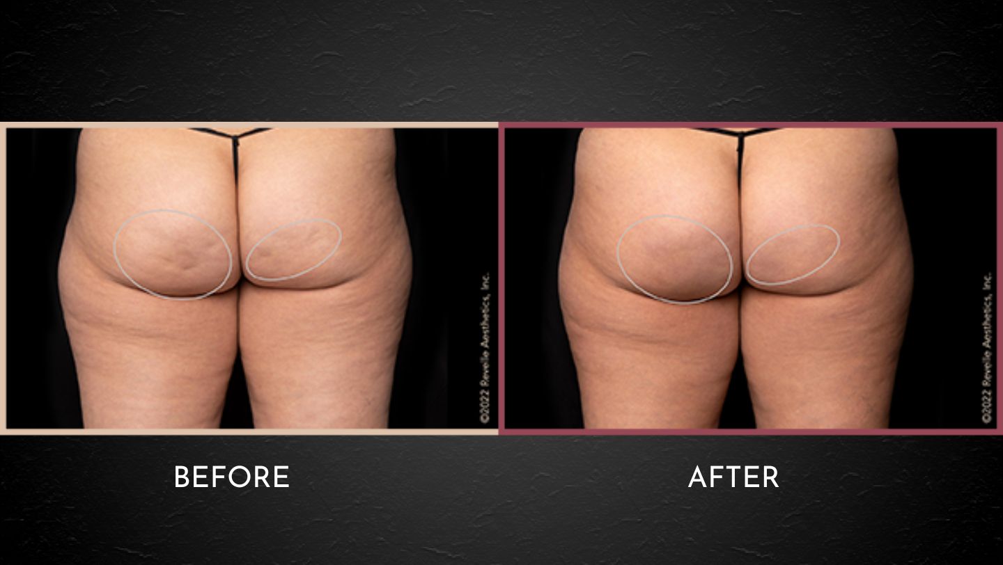 PSP Before After Layout Website (2)