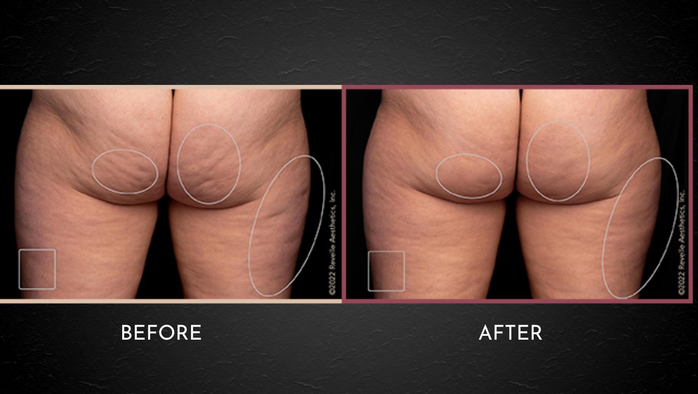 PSP Before After Layout Website (3)