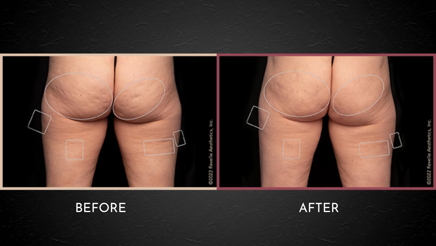 PSP Before After Layout Website (4)