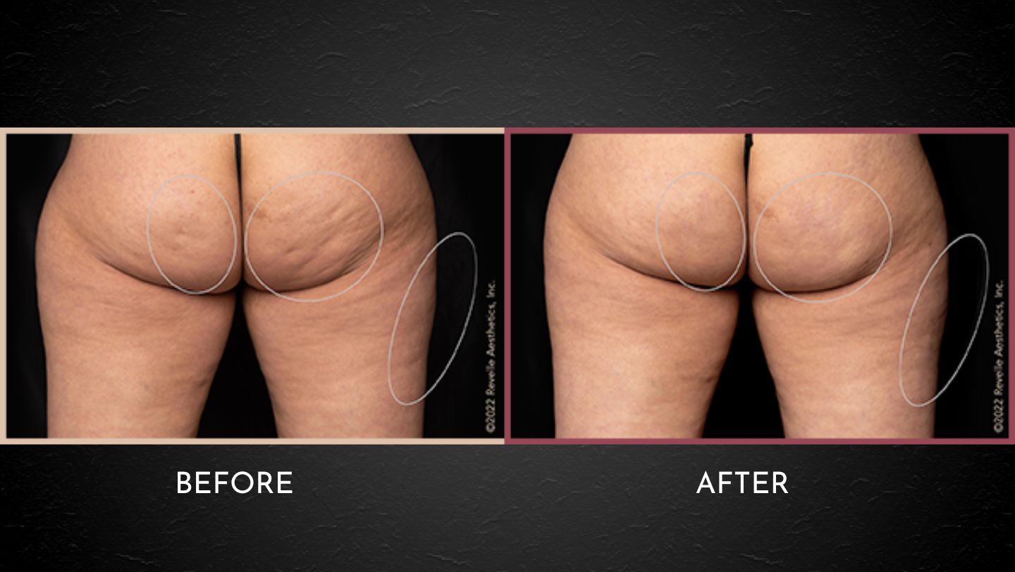 PSP Before After Layout Website